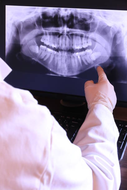 Best Emergency Dental Care for Abscessed Tooth in New Mford, IL