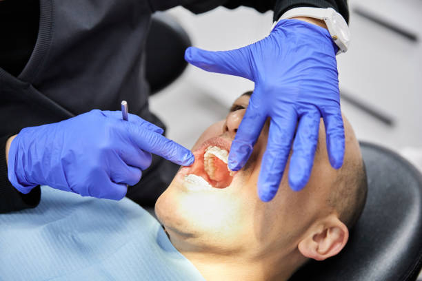 Best Emergency Dental Extractions in New Mford, IL